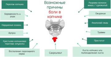 21 Неделя беременности болит копчик