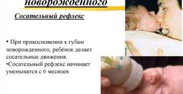 Нарушение сосательного рефлекса у новорожденного Нарушение сосательного рефлекса у новорожденного