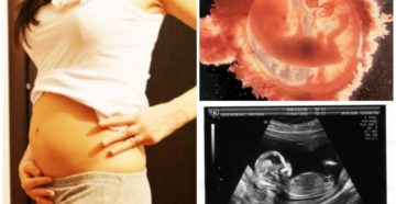 Акушерская 13 неделя беременности