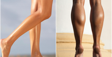 Полнеют икры ног от чего