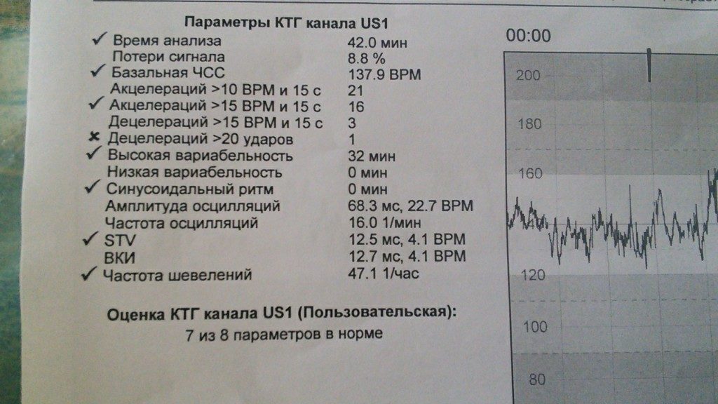 Расшифровка ктг плода 32 недели