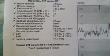 Расшифровка ктг плода 32 недели
