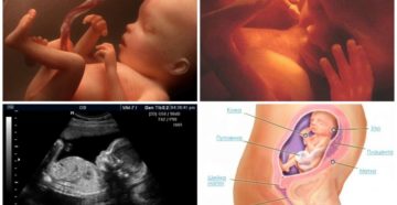 23 недели и 4 дня беременности 23 недели и 4 дня беременности